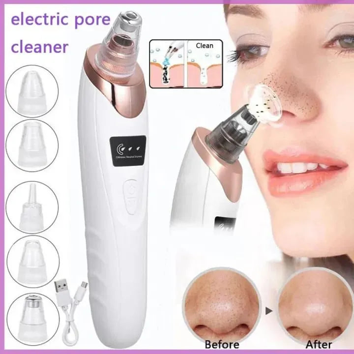 💕⚡ Face Vacuum Suction Blackhead Remover – Electric Deep Pore Cleansing Tool for Nose & Face 🌸