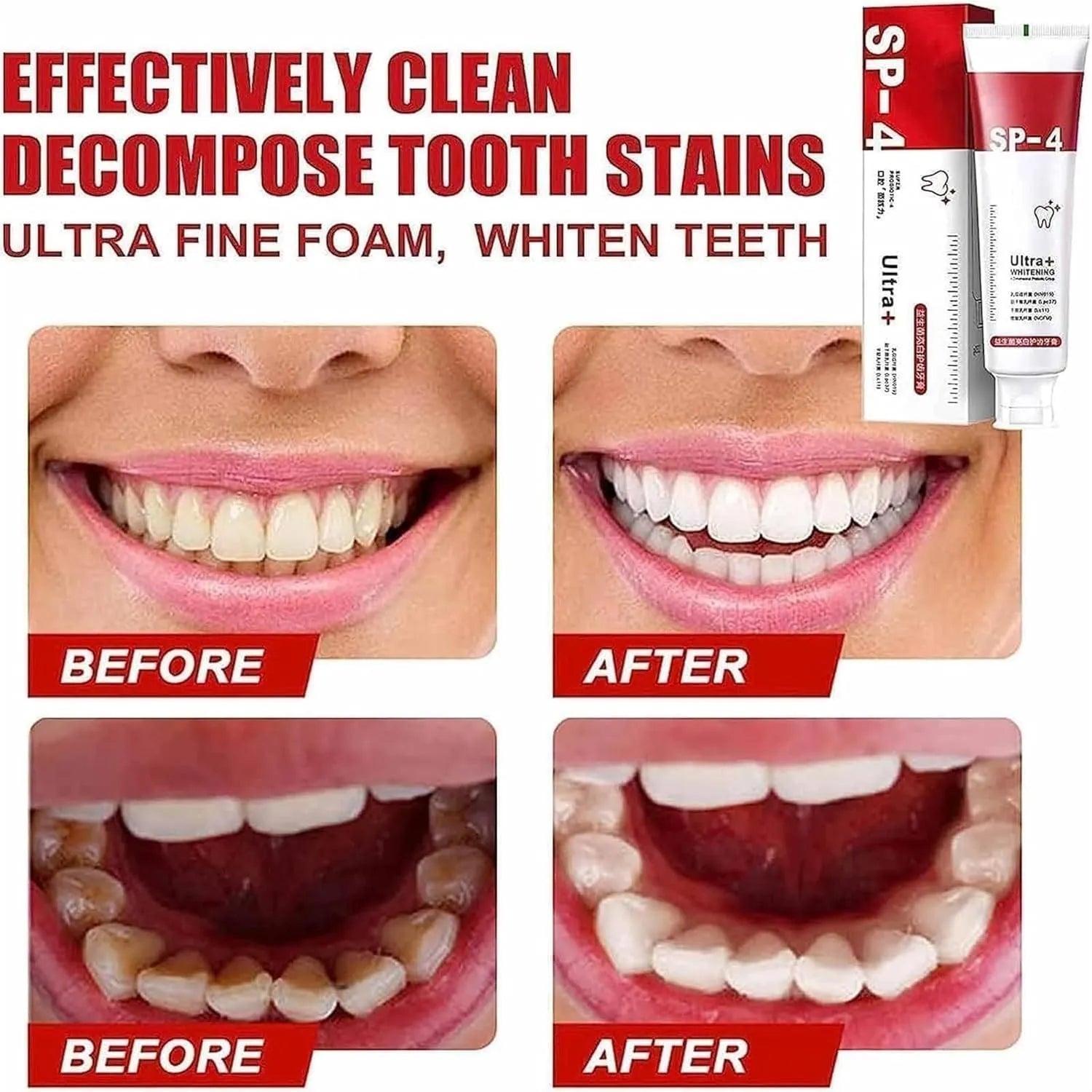 🦷💎 Yayashi SP-4 Ultra Whitening Toothpaste – Bright Smile, Fresh Breath & Strong Gums 💖