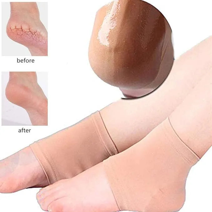 🦶💧 Moisturizing Silicone Gel Heel Socks – Comfort, Cushion & Care for Your Feet ✨