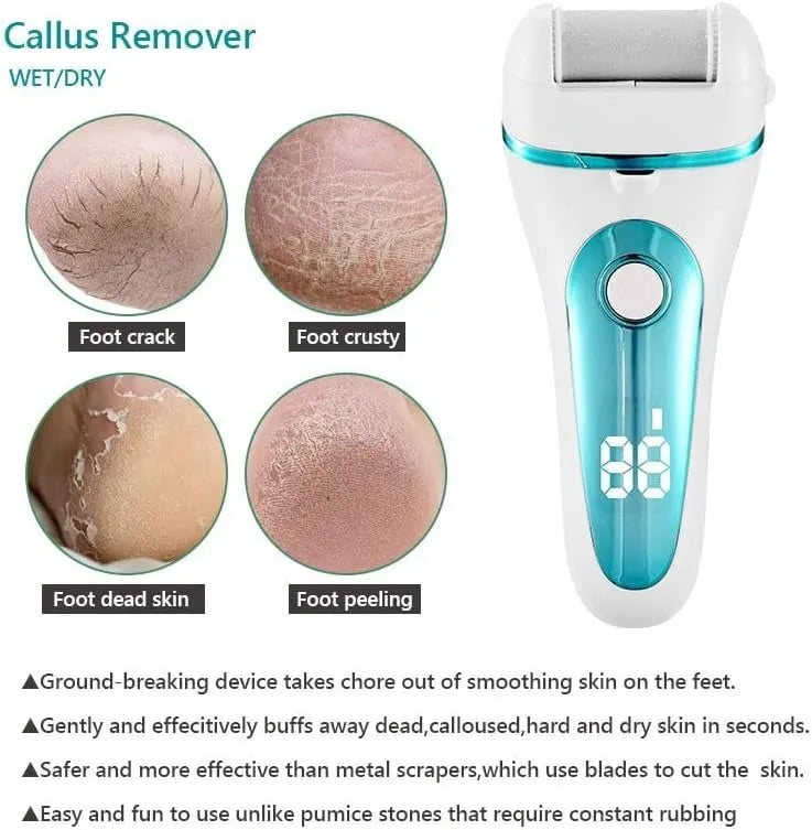 🌸👣 Electric Foot File Grinder – Baby-Soft Feet Anytime ✨💆‍♀️