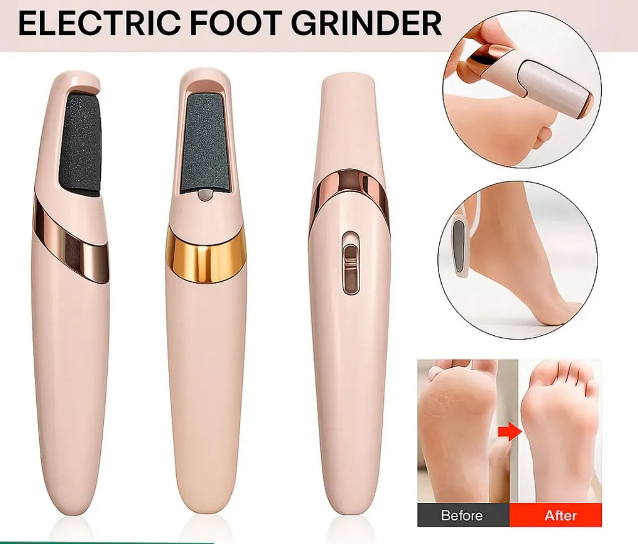 🦶💎 Electric Foot File Grinder – Smooth, Soft & Beautiful Feet Instantly 💖