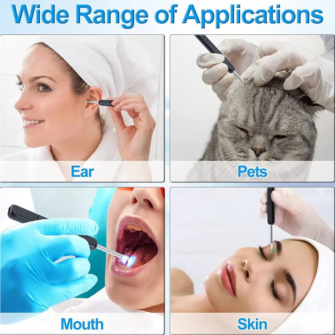 👂💧 Waterproof Ear Wax Removal Cleaner Kit – Safe & Gentle Cleaning ✨
